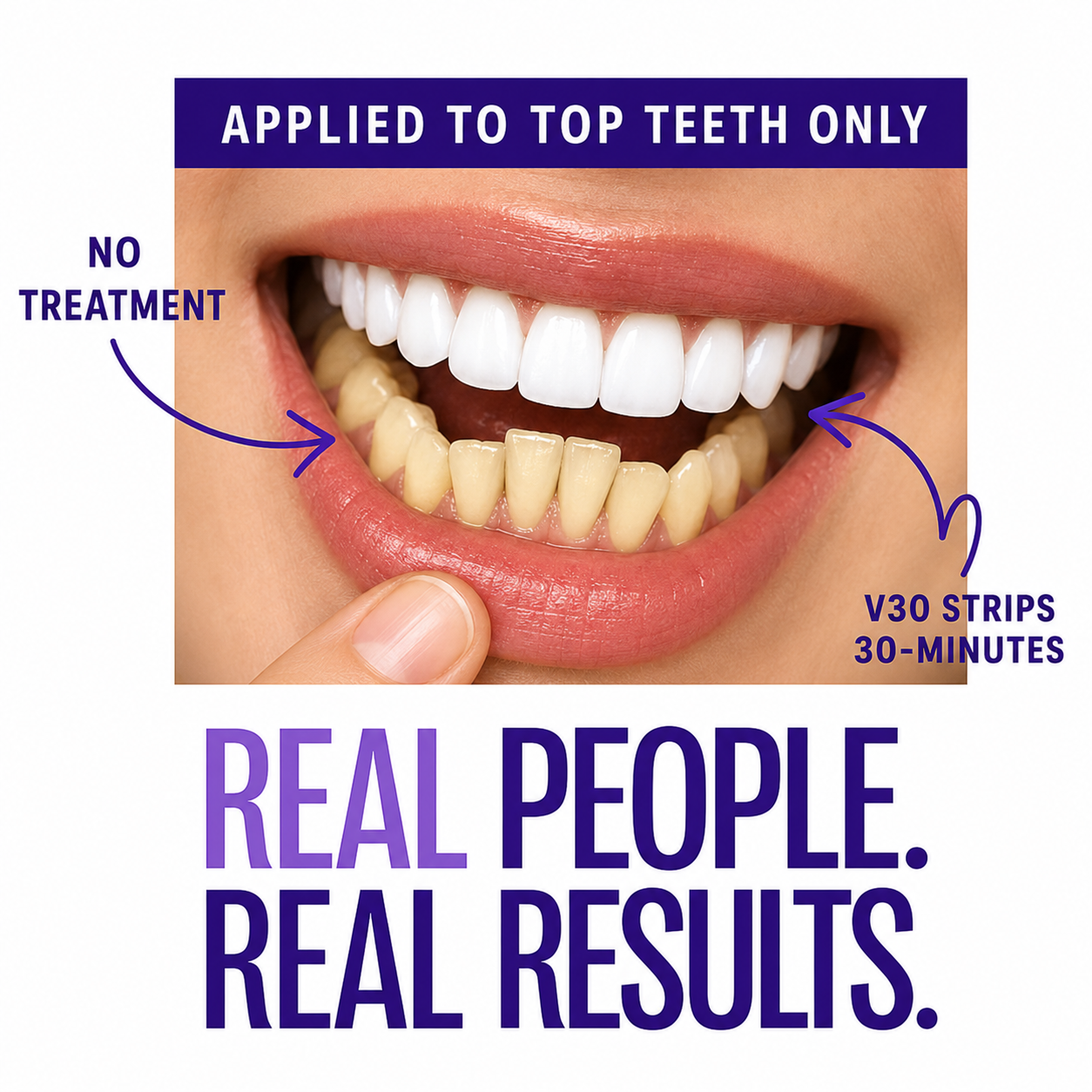 Purple Teeth Whitening Strips