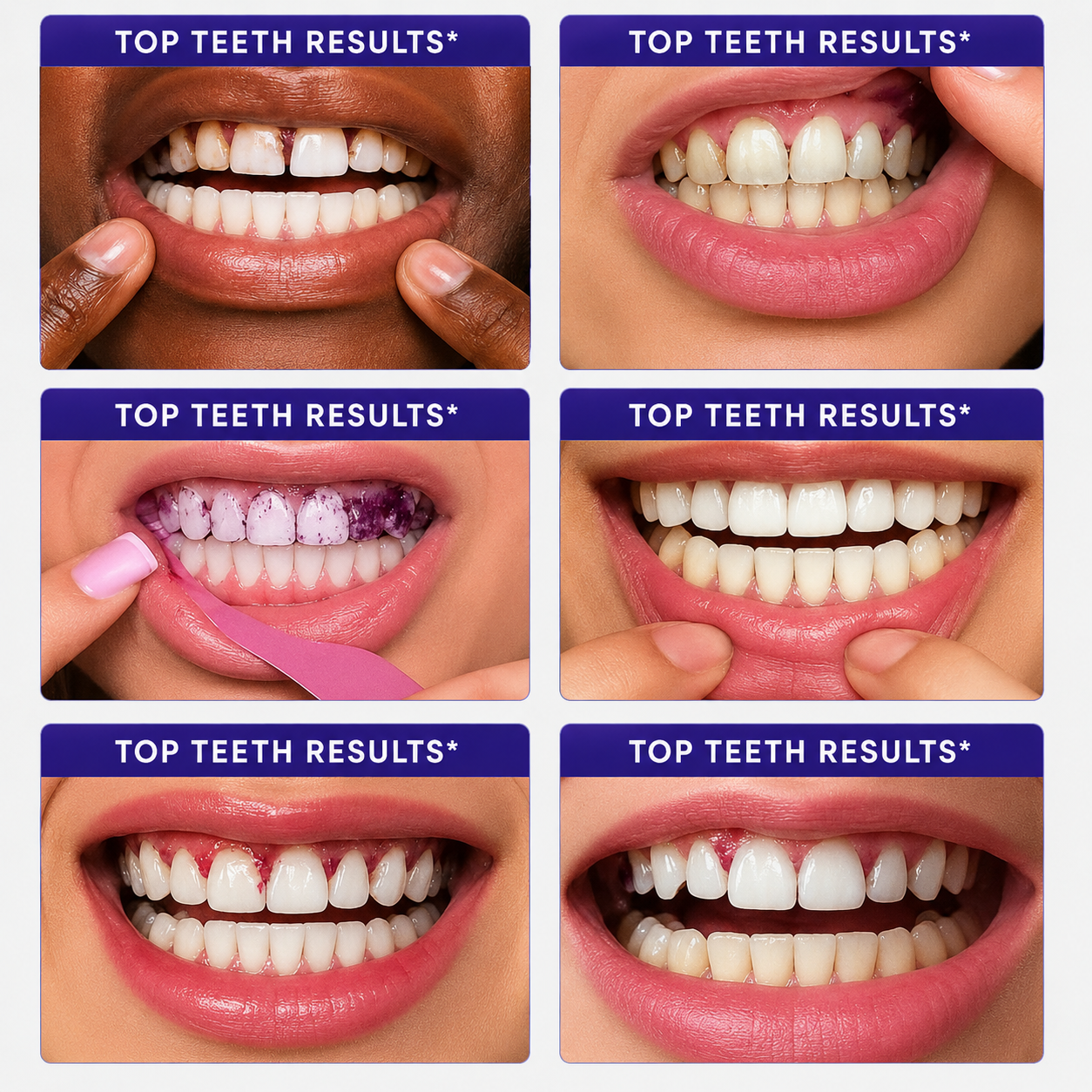 Purple Teeth Whitening Strips