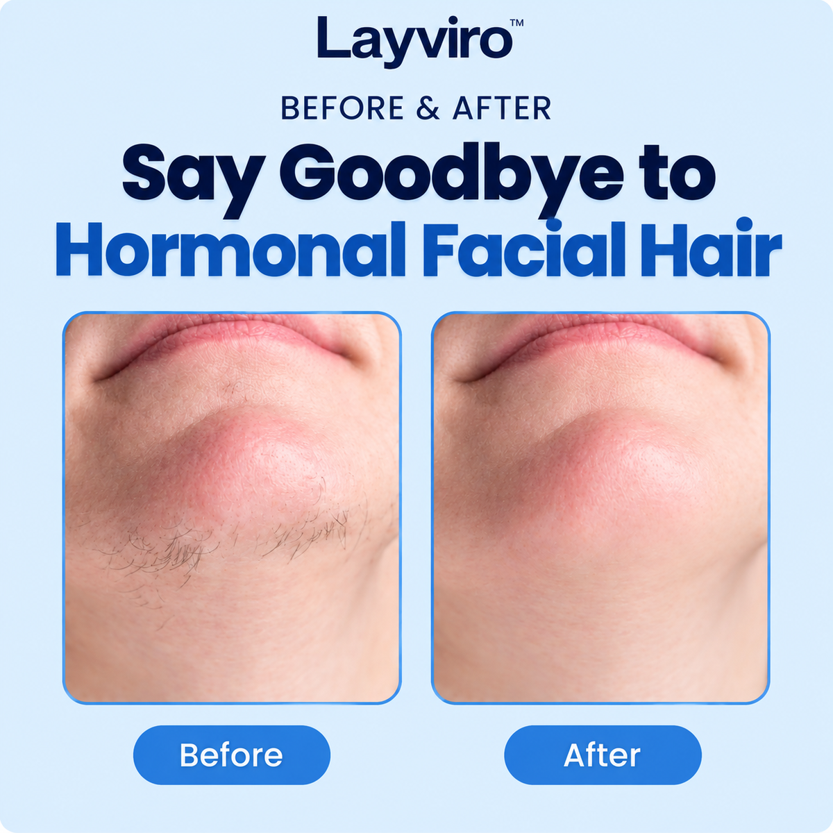 Mini Electric Rechargeable Hair Removal Device