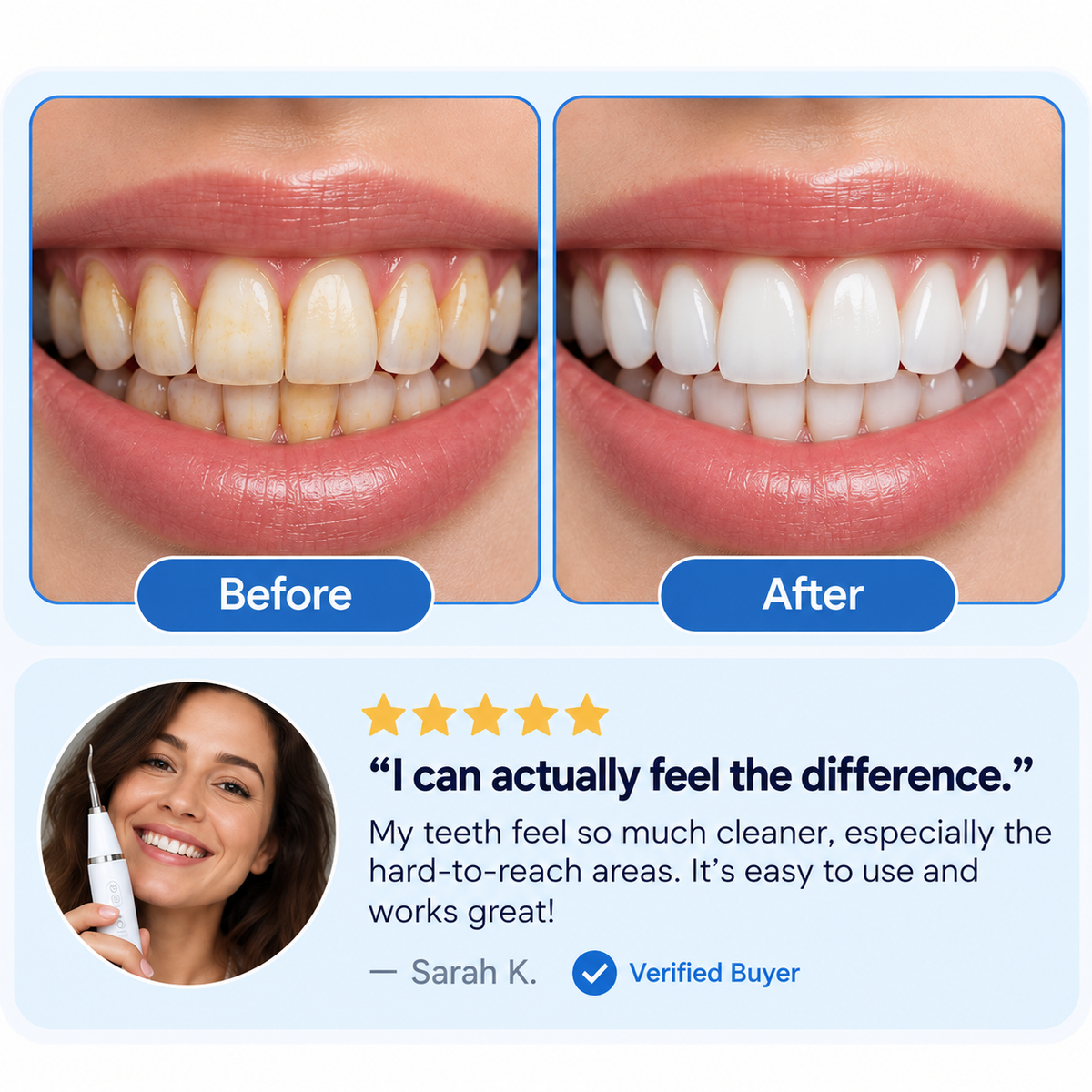 LAYVIRO ™ Complete Oral
Full Care Kit (everything included)