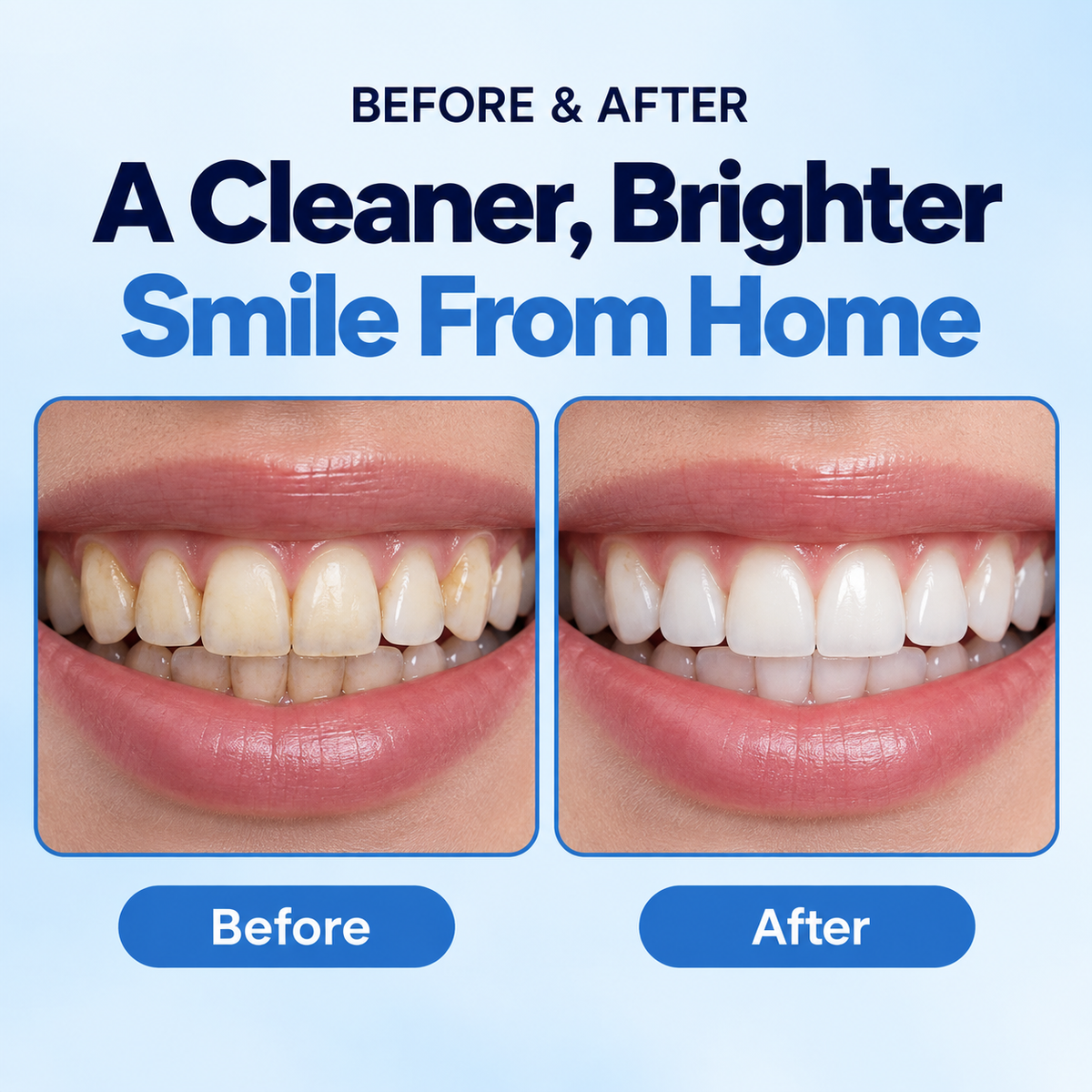 LAYVIRO ™ Complete Oral
Full Care Kit (everything included)