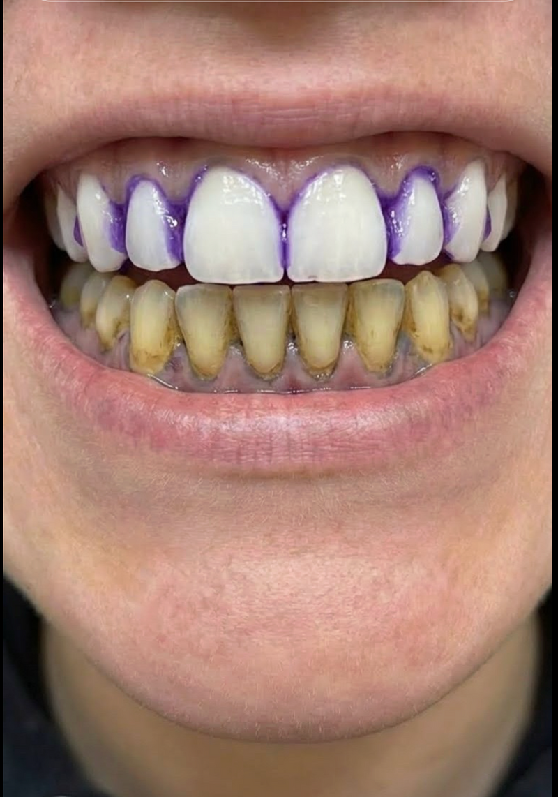 My Smile Looks So Much Better